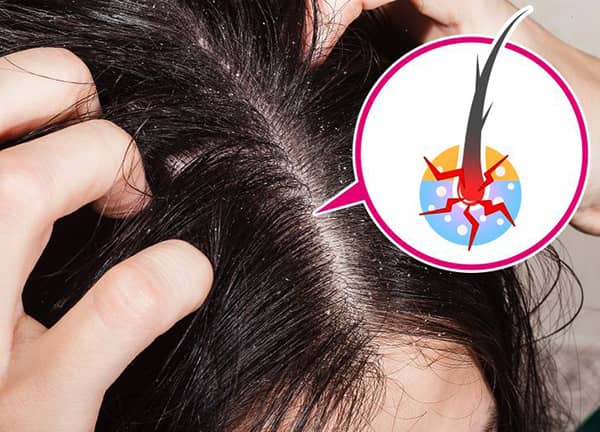 sac incelmesinin nedenleri