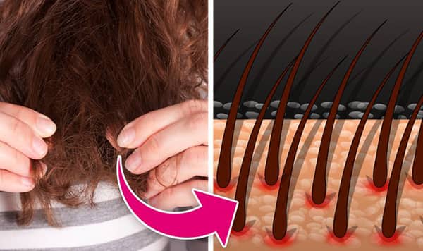 sac incelmesinin nedenleri