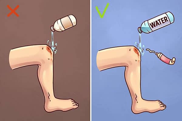 ilk yardim yanlislari