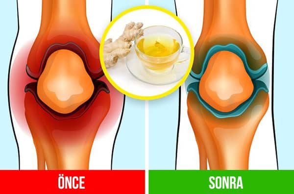 zencefil cayi faydalari