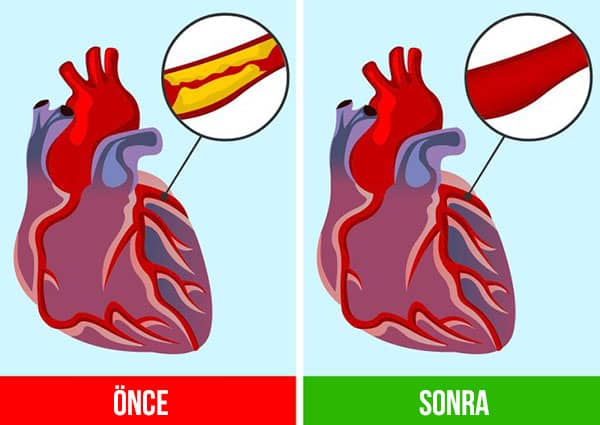 zencefilin faydalari