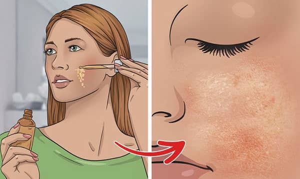 cilde zarar veren urunler